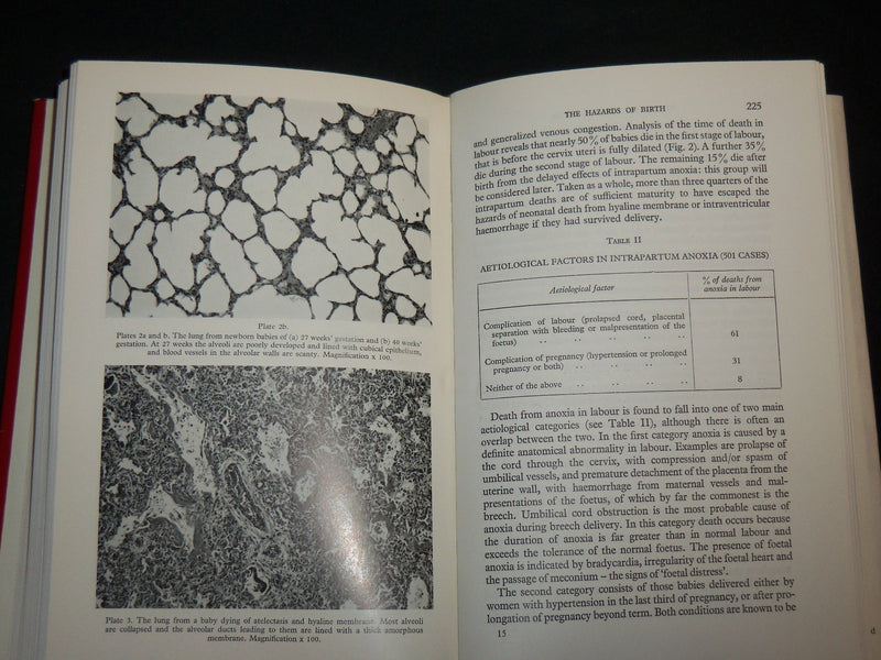1966 ADVANCES IN REPRODUCTIVE PHYSIOLOGY BOOK EDITED BY ANNE MCLAREN - KD 6628