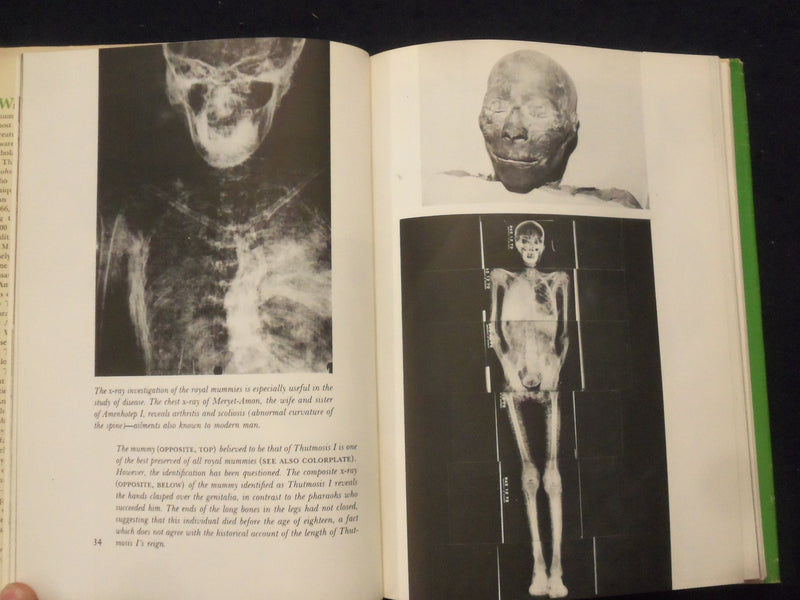 1973 X-RAYING THE PHARAOHS HARDCOVER BOOK BY JAMES HARRIS & KENT WEEKS - KD 8276