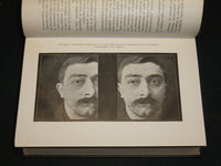 1906-1922 ANNALES D'OCULISTIQUE FRENCH VOLUMES LOT OF 8 - NICE PLATES - KD 21E