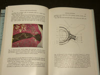1961 DISEASES OF THE INTERVERTEBRAL DISC BOOK BY REUBEN RABINOVITCH MD - KD 6271