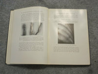 1921 INJURIES & DISEASES OF THE BONES AND JOINTS BY BAETJER & WATERS - KD 2759C