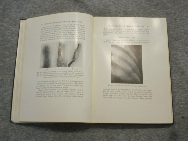 1921 INJURIES & DISEASES OF THE BONES AND JOINTS BY BAETJER & WATERS - KD 2759C