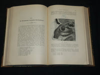 1894-1904 ARCHIV FUR LARYNGOLOGIE UND RHINOLOGIE GERMAN VOLUMES LOT OF 13 - KD 9