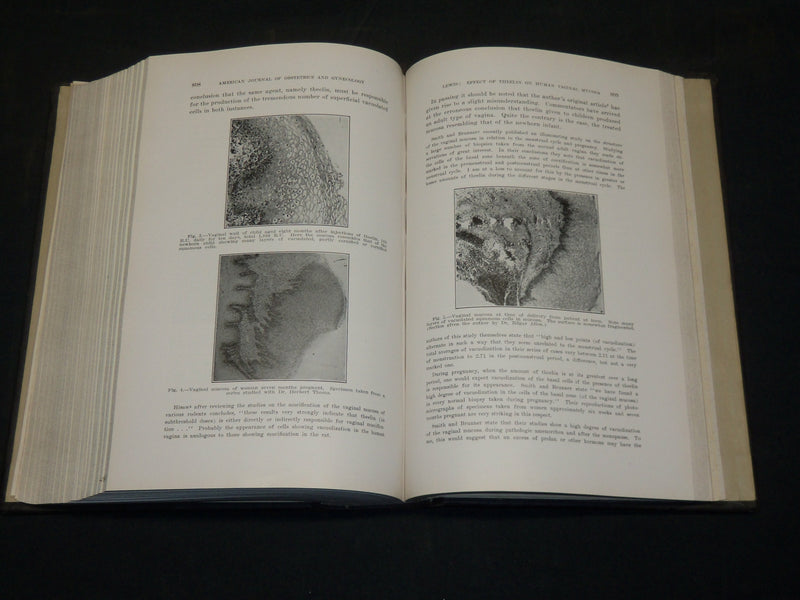 1935 JANUARY-JUNE AMERICAN JOURNAL OF OBSTETRICS & GYNECOLOGY VOLUME - KD 5912