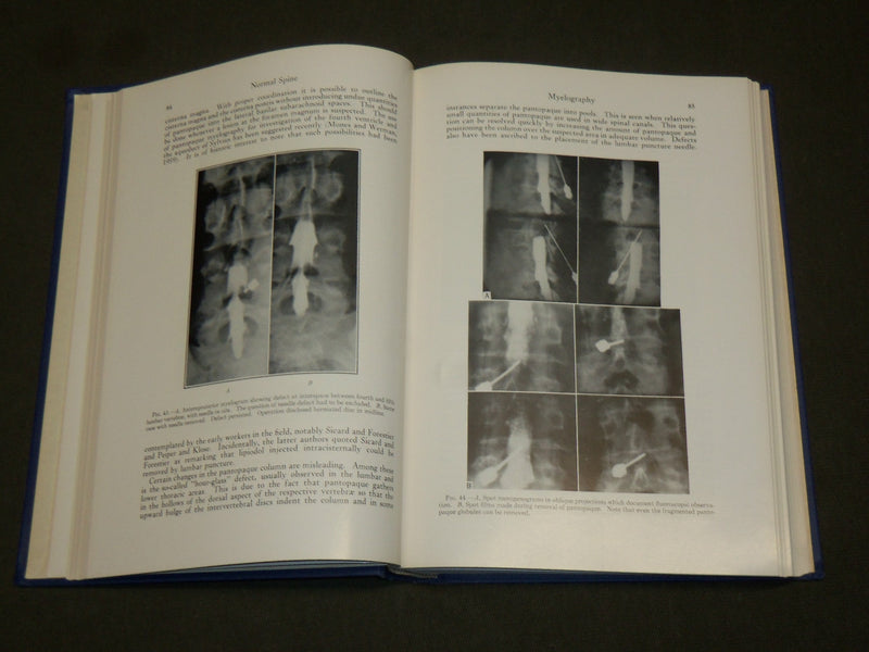 1962 THE SPINE A RADIOLOGICAL TEXT AND ATLAS BOOK BY BERNARD S. EPSTEIN- KD 6284