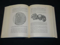 1916 GYNECOLOGY BOOK BY WILLIAM P. GRAVES M. D. - NICE ILLUSTRATIONS - KD 2755X