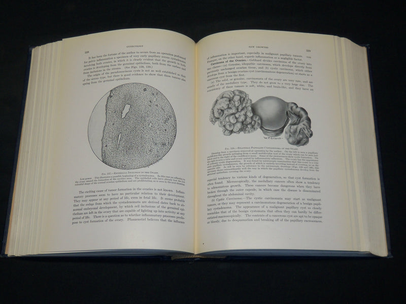 1916 GYNECOLOGY BOOK BY WILLIAM P. GRAVES M. D. - NICE ILLUSTRATIONS - KD 2755X
