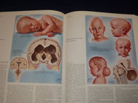 1977 CIBA COLLECTION OF MEDICAL ILLUSTRATIONS VOL. 1 - NERVOUS SYSTEM - KD 2708