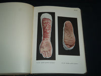 1913 PORTFOLIO OF DERMOCHROMES BY JEROME KINGSBURY VOLUMES 1-3 - KD 986