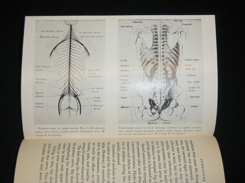 1948 THE BACK AND ITS DISORDERS HARDCOVER BOOK BY PHILIP LEWIN, M. D.- KD 6469
