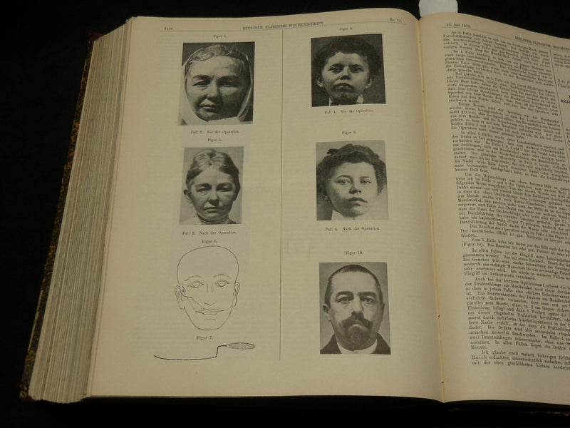 1910 JAN-JUN BERLINER KLINISCHE WOCHENSCHRIFT MAGAZINE BOUND VOLUME - KD 3644C