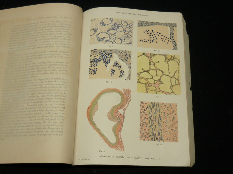 1905-1907 THE JOURNAL OF MENTAL PATHOLOGY MAGAZINE LOT OF 7 - WR 572K