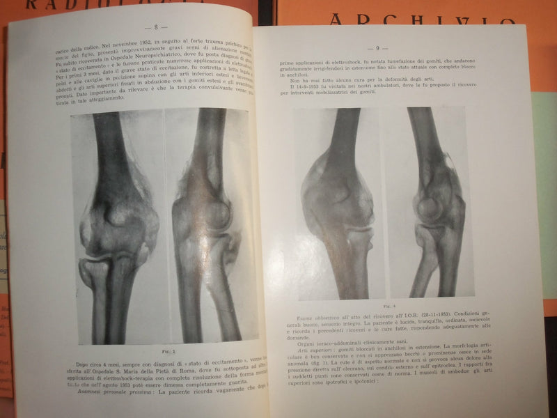 1933-1956 ARCHIVIO DI RADIOLOGIA LOT OF 86 ISSUES - ITALIAN TEXT - WR 452
