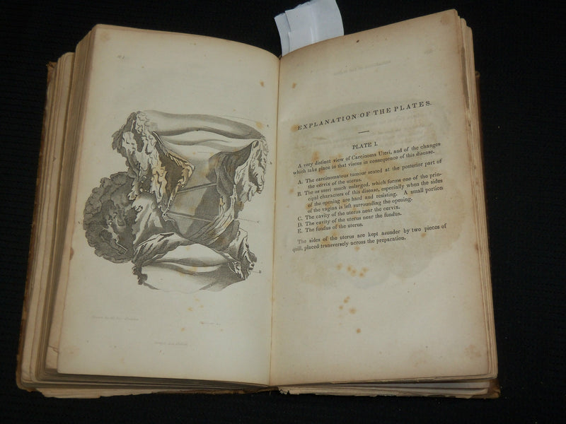 1843 TREATISE ON THE DISEASES OF FEMALES HARDCOVER BOOK - DEWEES M. D. - KD 7487