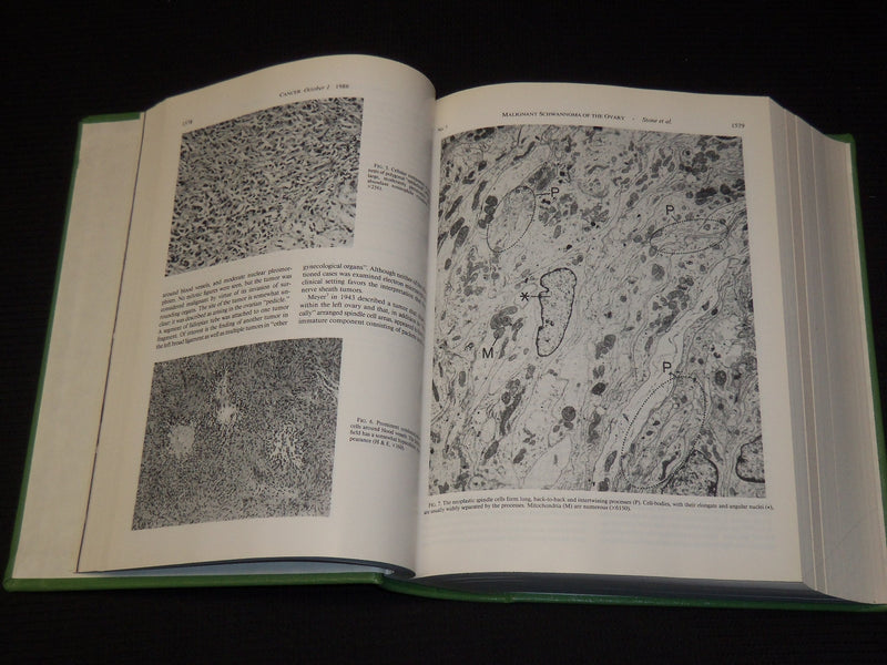 1982-1988 CANCER JOURNAL MAGAZINE BOUND VOLUMES LOT OF 6 - KD 1I