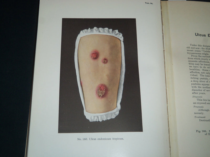 1913 PORTFOLIO OF DERMOCHROMES BY JEROME KINGSBURY VOLUMES 1-3 - KD 986