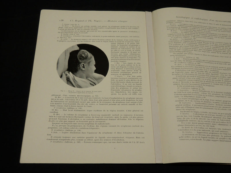 1916-1917 JOURNAL DE RADIOLOGIE ET ELECTROLOGIE MAGAZINE LOT OF 6 - O 1410T