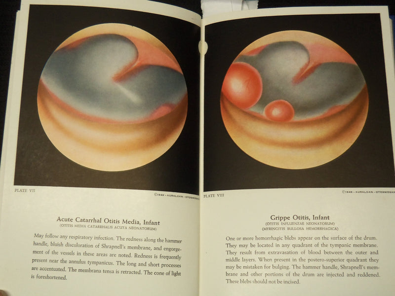 1946 AN AURAL ATLAS - AURALGAN RESEARCH DIV. RED CROSS BOOK - 49 PLATES- KD 9515