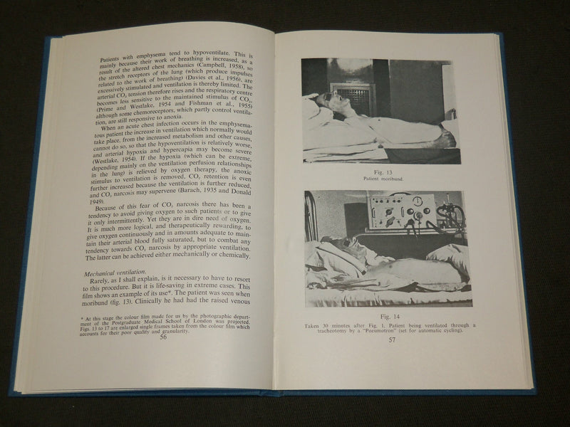 1959 SYMPOSIUM ON PULMONARY VENTILATION BOOK EDITED BY HARBORD & WOOLMER-KD 6065