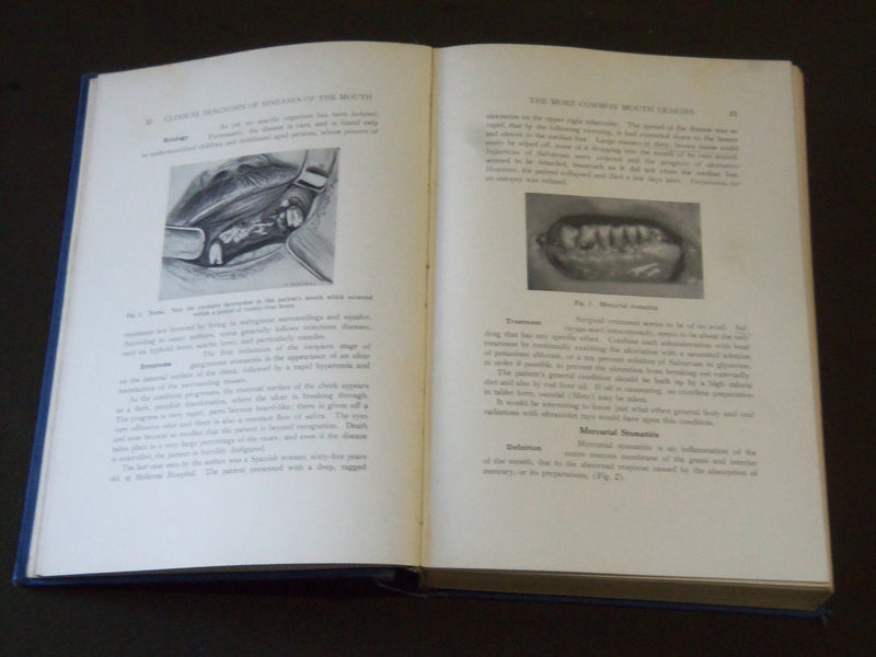 1936 CLINICAL DIAGNOSIS OF DISEASES OF THE MOUTH BY LOUIS V. HAYES - KD 3996