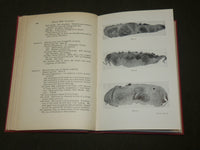 1950 TOXAEMIAS OF PREGNANCY - CIBA FOUNDATION SYMPOSIUM BOOK - KD 6115