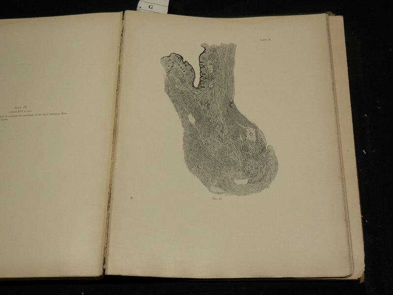 1912 STUDIES IN CANCER - PATHOLOGY BOUND VOLUME NO. 2 - 32 PLATES - KD 4500