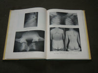 1953 MAN'S BACK HARDCOVER BOOK BY THEODORE A. WILLIS M. D. - KD 6215