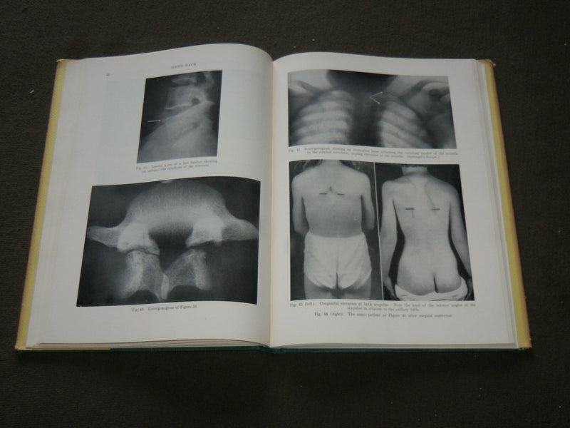 1953 MAN'S BACK HARDCOVER BOOK BY THEODORE A. WILLIS M. D. - KD 6215