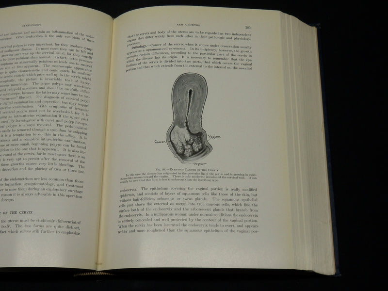 1916 GYNECOLOGY BOOK BY WILLIAM P. GRAVES M. D. - NICE ILLUSTRATIONS - KD 2755X