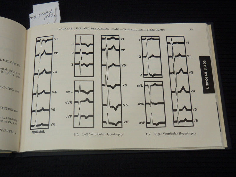 1952 P-Q-R-S-T ELECTROCARDIOGRAM GUIDE BOOK - RISEMAN - 3RD EDITION - K 2691