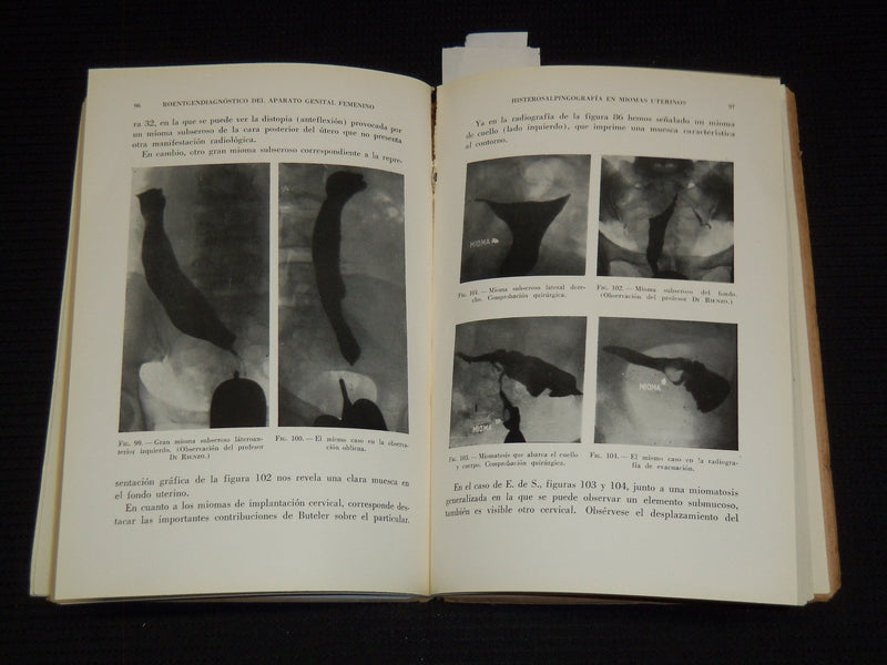 1953 ROENTGENDIAGNOSTICO DEL APARATO GENITAL FEMENINO BY JUAN ZORRILLA - J 7421
