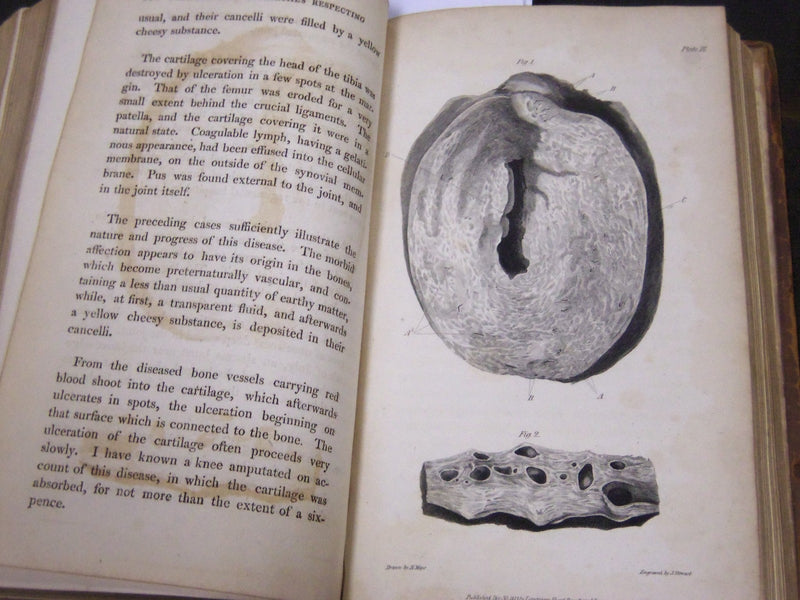 1813 MEDICO-CHITRURGICAL TRANSACTIONS VOLUME NO. 4 - NICE PLATES - KD 2059L