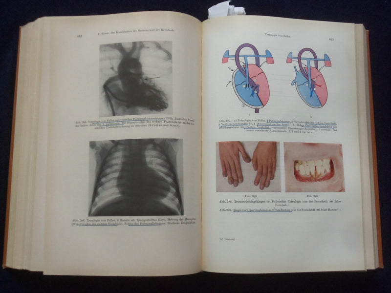 1961 LEHRBUCH DER PADIATRIE HARDCOVER BOOK - GERMAN TEXT - KD 8990