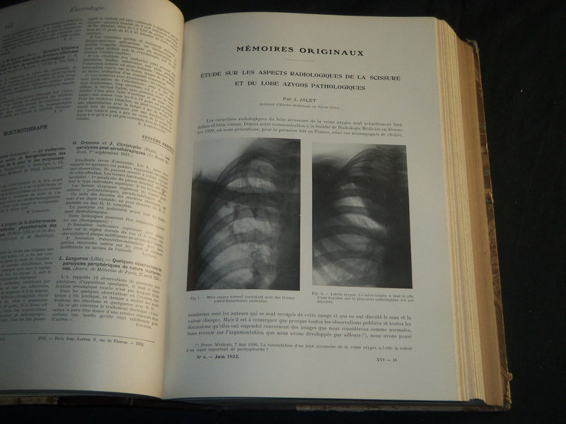 1932-1938 JOURNAL DE RADIOLOGIE ET D'ELECTROLOGIE BOUND VOLUMES LOT OF 6 - KD 6