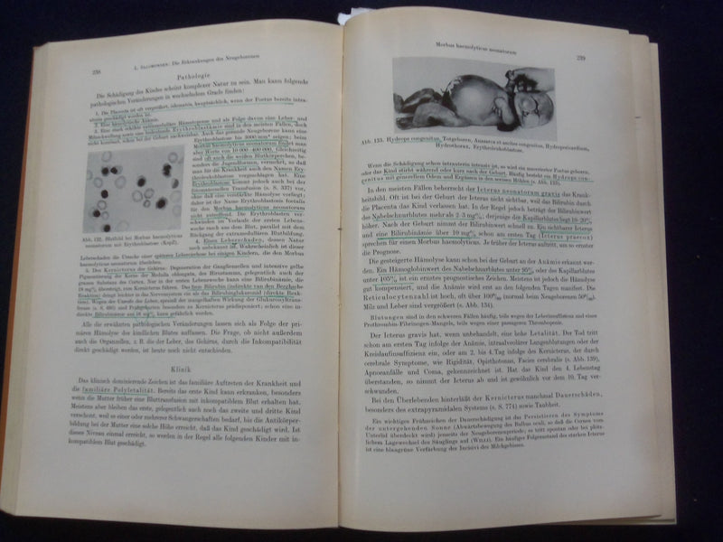 1961 LEHRBUCH DER PADIATRIE HARDCOVER BOOK - GERMAN TEXT - KD 8990