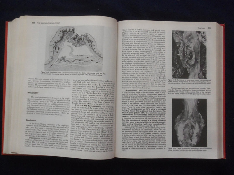 1984 PATHOLOGIC BASIS OF DISEASE HARDCOVER BOOK - ROBBINS-COTRAN-KUMAR - KD 8892
