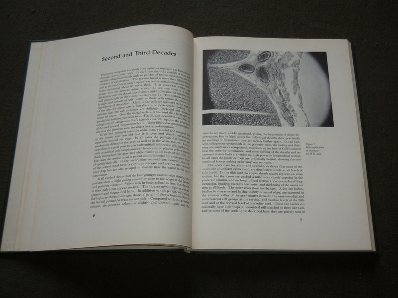 1959 EFFECT OF ADVANCING AGE UPON THE HUMAN SPINAL CORD BOOK - KD 6216