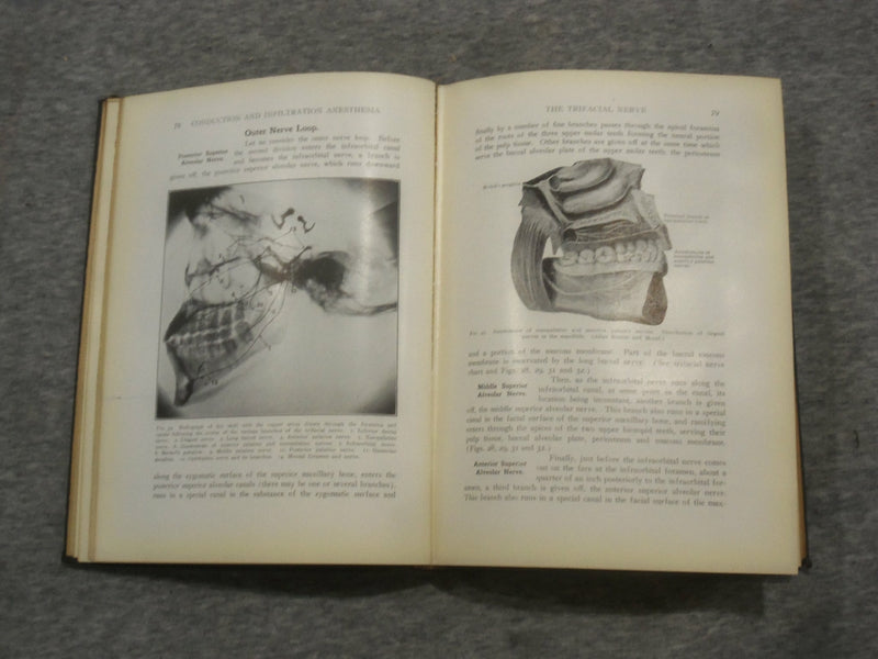 1923 CONDUCTION AND INFILTRATION ANESTHESIA BY MENDEL NEVIN - KD 2758Q