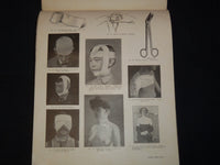 1915 MODERN SURGICAL NURSING BY EUGENE UNDERHILL, M. D. - 9 PARTS - O 3638D