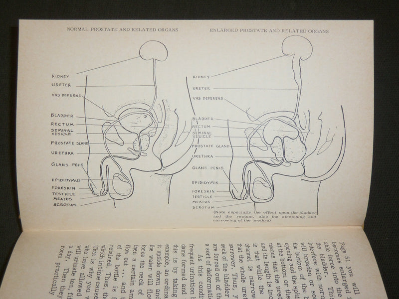1970 YOUR PROSTATE TREATMENT AND PREVENTION BOOK JOHN H. TOBE - KD 6111