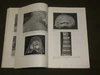 1940 MARCH ARCHIVES OF SURGERY SYMPOSIUM ON INTERVERTEBRAL DISKS - KD 6267