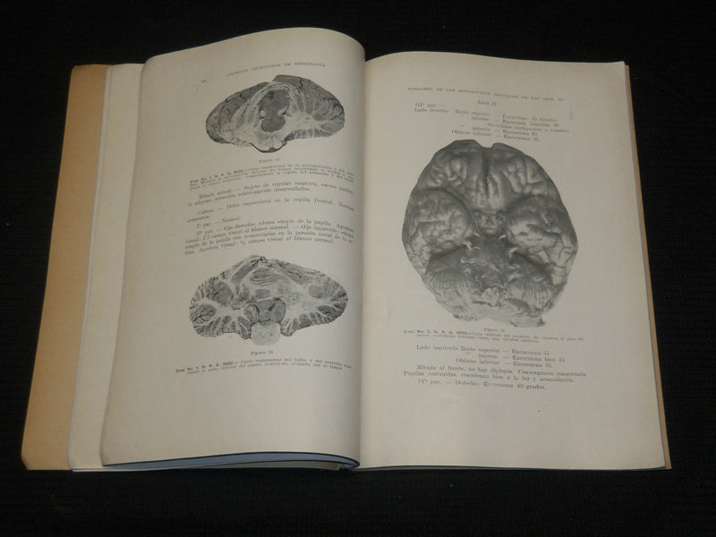 1927-1935 ARCHIVES ARGENTINOS DE NEUROLOGIA SPANISH MAGAZINES LOT OF 5 - WR 505E