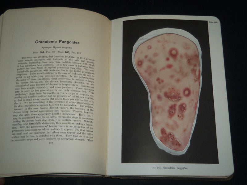 1913 PORTFOLIO OF DERMOCHROMES BY JEROME KINGSBURY VOLUMES 1-3 - KD 986