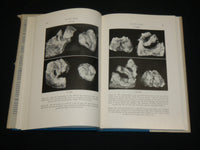 1957 DEGENERATIVE CHANGES IN THE STERNOCLAVICULAR JOINTS BOOK DEPALMA - KD 6362
