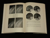 1954 ULTRASONIC AND ULTRASHORT WAVES IN MEDICINE BOOK - KD 2768P
