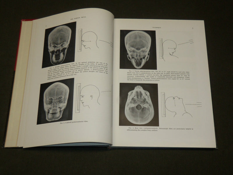 1960 THE NORMAL SKULL A ROENTGEN STUDY BOOK BY SHAPIRO & JANSEN - KD 6294