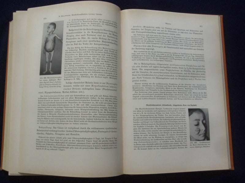 1961 LEHRBUCH DER PADIATRIE HARDCOVER BOOK - GERMAN TEXT - KD 8990
