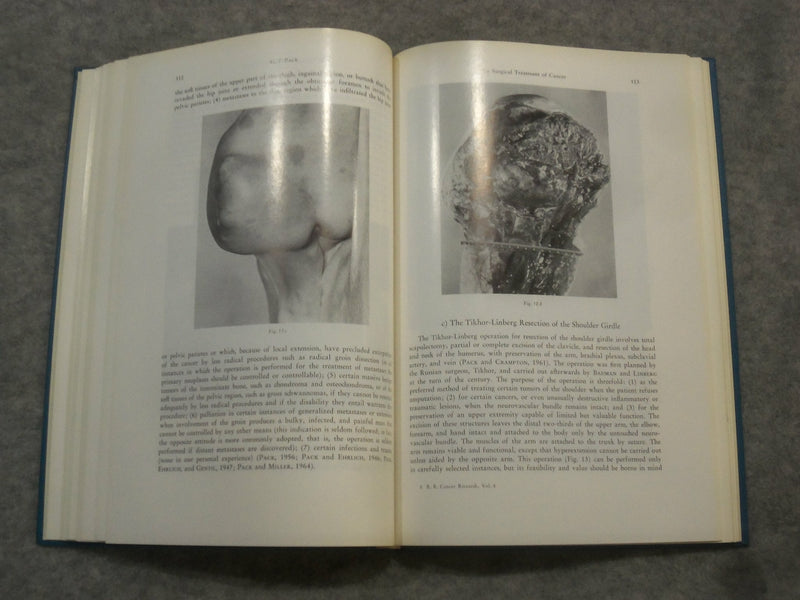 1967 NEW TRENDS IN THE TREATMENT OF CANCER EDITED BY L. MANUILA - KD 2759M
