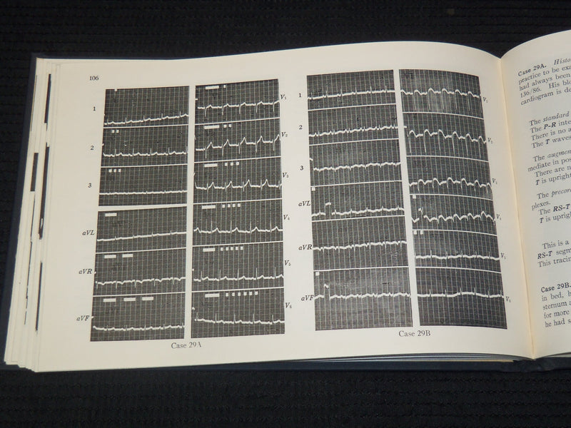 1952 P-Q-R-S-T ELECTROCARDIOGRAM GUIDE BOOK - RISEMAN - 3RD EDITION - K 2691
