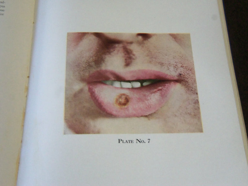 1936 CLINICAL DIAGNOSIS OF DISEASES OF THE MOUTH BY LOUIS V. HAYES - KD 3996